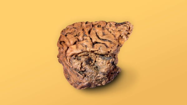 Overraskede forskere: 2.600 år gammelt skelet havde velbevaret hjerne
