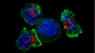 Hovsa-opdagelse: Forskere finder celle, der angriber flere kræfttyper  