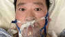 Læge advarede om coronavirus: Hospital erklærer ham død